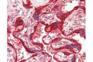 Human Placenta: Formalin-Fixed, Paraffin-Embedded (FFPE) (IL1RL1 antibody  (AA 162-349))