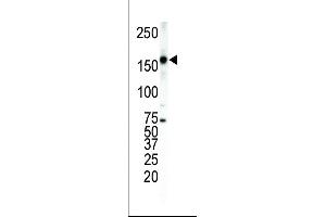 Western blot analysis of anti-ErbB4 Pab (ABIN391951 and ABIN2841749) in T-47D cell lysate. (ERBB4 antibody  (C-Term))