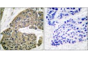 Immunohistochemistry (IHC) image for anti-Keratin 5 (KRT5) (AA 541-590) antibody (ABIN1533326)