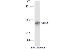 Mouse placenta lysate probed with Rabbit Anti-GRF2 Polyclonal Antibody, Unconjugated (ABIN2559496) at 1:300 in 4˚C. (Ras Protein-Specific Guanine Nucleotide-Releasing Factor 2 (RASGRF2) (AA 20-120) antibody)