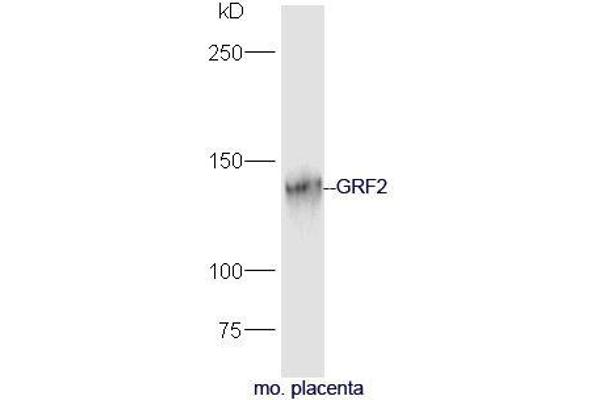 Ras Protein-Specific Guanine Nucleotide-Releasing Factor 2 (RASGRF2) (AA 20-120) antibody