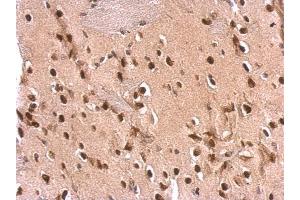 IHC-P Image ETS2 antibody detects ETS2 protein at nucleus on rat fore brain by immunohistochemical analysis. (ETS2 antibody  (Center))