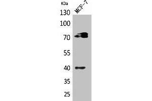 Western Blot analysis of MCF7 cells using CD110 Polyclonal Antibody. (MPL antibody  (Internal Region))