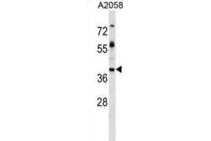 Western Blotting (WB) image for anti-Trophoblast Glycoprotein (TPBG) antibody (ABIN2999221)