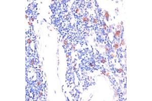 Immunohistochemistry (IHC) image for anti-Wingless-Type MMTV Integration Site Family, Member 5B (WNT5B) (AA 120-359) antibody (ABIN6150250)