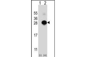 Western blot analysis of MOBKL1B (arrow) using rabbit polyclonal MOBKL1B Antibody (C-term) (ABIN391568 and ABIN2841505). (MOB1A antibody  (C-Term))