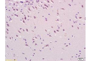 Formalin-fixed and paraffin embedded rat brain labeled with Anti-phospho-Tau protein(Ser396) Polyclonal Antibody, Unconjugated (ABIN746453) at 1:200 followed by conjugation to the secondary antibody (tau antibody  (pSer396))