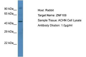 Host: Rabbit Target Name: ZNF169 Sample Type: ACHN Whole cell lysates Antibody Dilution: 1. (ZNF169 antibody  (C-Term))