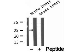 Western blot analysis of extracts of mouse heart tissue, using ATP5F1 antibody. (ATP5F1 antibody  (Internal Region))