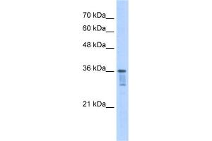 WB Suggested Anti-LZTFL1 Antibody Titration:  2. (LZTFL1 antibody  (C-Term))