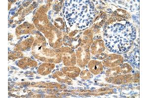 Immunohistochemistry (IHC) image for anti-Transmembrane Protein 69 (TMEM69) (Middle Region) antibody (ABIN2782891) (TMEM69 antibody  (Middle Region))