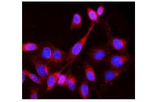 IF analysis of Lck using anti-Lck antibody (ABIN3043870). (LCK antibody  (C-Term))