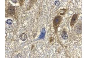 Immunohistochemistry of GbL in mouse brain tissue with GbL antibody at 10 μg/ml. (GBL antibody)