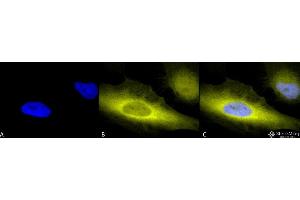 Immunocytochemistry/Immunofluorescence analysis using Rabbit Anti-Ubiquitin Polyclonal Antibody . (Ubiquitin antibody  (Biotin))