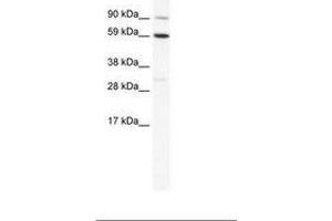 Image no. 1 for anti-T-Bet (AA 455-504) antibody (ABIN202721)