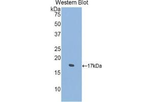 Western blot analysis of the recombinant protein. (SEMA4D/CD100 antibody  (AA 502-636))