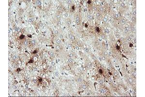 Image no. 2 for anti-Kallikrein 8 (KLK8) antibody (ABIN1498966) (Kallikrein 8 antibody)