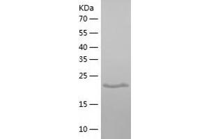 Western Blotting (WB) image for Glutathione Transferase zeta 1 (Maleylacetoacetate Isomerase) (GSTZ1) (AA 1-216) protein (His tag) (ABIN7284477) (GSTZ1 Protein (AA 1-216) (His tag))