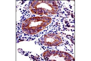 PHF16 Antibody (C-term) ((ABIN1537593 and ABIN2848809))immunohistochemistry analysis in formalin fixed and paraffin embedded human uterus tissue followed by peroxidase conjugation of the secondary antibody and DAB staining. (PHF16 antibody  (C-Term))