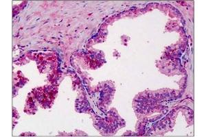 Human Prostate: Formalin-Fixed, Paraffin-Embedded (FFPE). (MMP3 antibody)