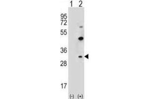 Western Blotting (WB) image for anti-Claudin 2 (CLDN2) antibody (ABIN2996860) (Claudin 2 antibody)