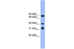 WB Suggested Anti-LAX1 Antibody Titration: 0. (LAX1 antibody  (C-Term))