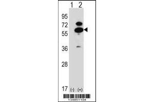 Western blot analysis of Oxsr1 using rabbit polyclonal Mouse Oxsr1 Antibody using 293 cell lysates (2 ug/lane) either nontransfected (Lane 1) or transiently transfected (Lane 2) with the Oxsr1 gene. (OXSR1 antibody  (N-Term))