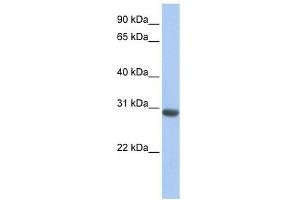 MLF1 antibody used at 1 ug/ml to detect target protein. (MLF1 antibody  (N-Term))