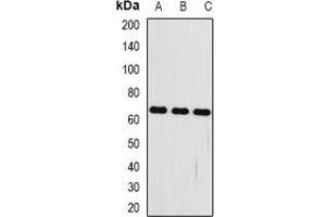 Western blot analysis of FRZB expression in mouse kidney (A), mouse heart (B), mouse brain (C) whole cell lysates.