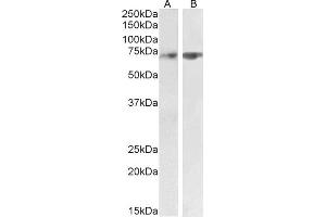 ABIN1590085 (2 μg/mL) staining of Human Cerebellum (A) and Rat Lung (B) lysate (35 μg protein in RIPA buffer). (SYVN1 antibody  (Internal Region))