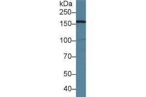 Detection of AIM1 in Human 293T cell lysate using Polyclonal Antibody to Absent In Melanoma 1 (AIM1) (AIM1 antibody  (AA 1502-1719))