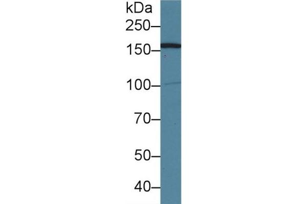 AIM1 antibody  (AA 1502-1719)