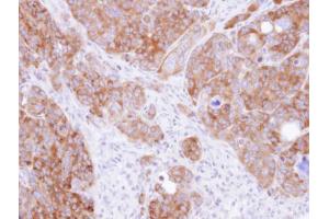 IHC-P Image Immunohistochemical analysis of paraffin-embedded SW480 xenograft, using DARS, antibody at 1:500 dilution. (DARS antibody)