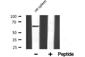Western blot analysis of NF-kappaB p65 expression in Rat spleen lysate (NF-kB p65 antibody)