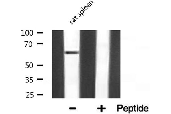 NF-kB p65 Antikörper