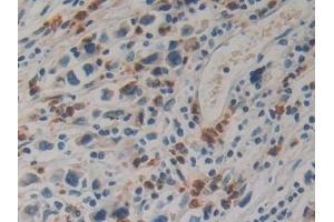 Immunohistochemistry (IHC) image for anti-Kallikrein 10 (KLK10) (AA 35-276) antibody (ABIN7429862)