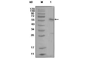 Western blot analysis using ESR1 mouse mAb against MCF-7 cell lysate (1) (Estrogen Receptor alpha antibody)