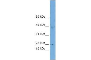 WB Suggested Anti-ARPC3  Antibody Titration: 0. (ARPC3 antibody  (Middle Region))