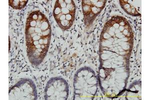 Immunoperoxidase of monoclonal antibody to KRT20 on formalin-fixed paraffin-embedded human colon tissue. (KRT20 antibody  (AA 1-424))