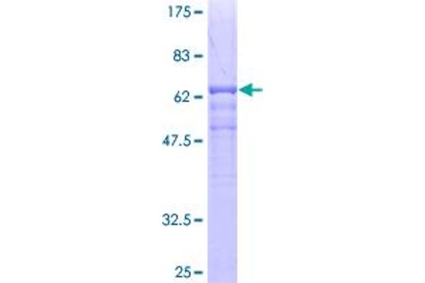 TCN2 Protein (AA 1-400) (GST tag)