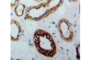 #VALUE! (JAG1 antibody  (AA 826-1084))