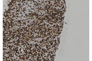 ABIN6273323 at 1/100 staining Human spleen tissue by IHC-P.