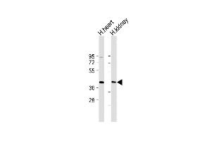 All lanes : Anti-DACL2 Antibody (Center) at 1:2000 dilution Lane 1: Human heart lysate Lane 2: Human kidney lysate Lysates/proteins at 20 μg per lane. (AADACL2 antibody  (AA 156-182))