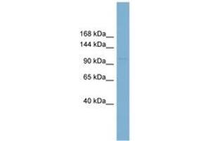 Image no. 1 for anti-Retinoblastoma Binding Protein 8 (RBBP8) (AA 791-840) antibody (ABIN6744900) (Retinoblastoma Binding Protein 8 antibody  (AA 791-840))