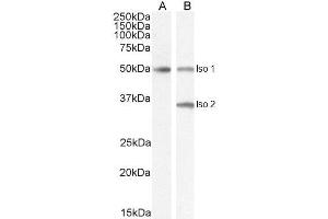 ABIN185645 (2µg/ml) staining of isoform 1 Human Brain (A) and isoform 1+2 (B) lysate (35µg protein in RIPA buffer).
