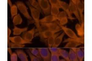Immunofluorescence analysis of HeLa cells using NME1 Polyclonal Antibody at dilution of 1:100. (NME1 antibody)