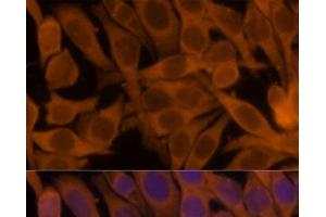 Immunofluorescence analysis of HeLa cells using NME1 Polyclonal Antibody at dilution of 1:100.