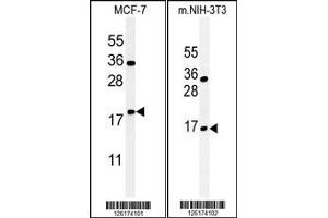 (LEFT)Western blot analysis of BTG1 Antibody in MCF-7 cell line lysates (35ug/lane).