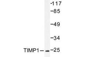Western blot analysis of TIMP-1 antibody in extracts from 293 cells. (TIMP1 antibody)