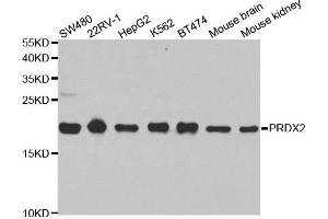 Western blot analysis of extracts of various cell lines, using PRDX2 antibody. (Peroxiredoxin 2 antibody  (AA 1-142))